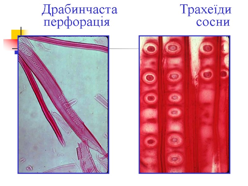 Драбинчаста             